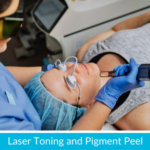 Laser Toning and Pigment peel