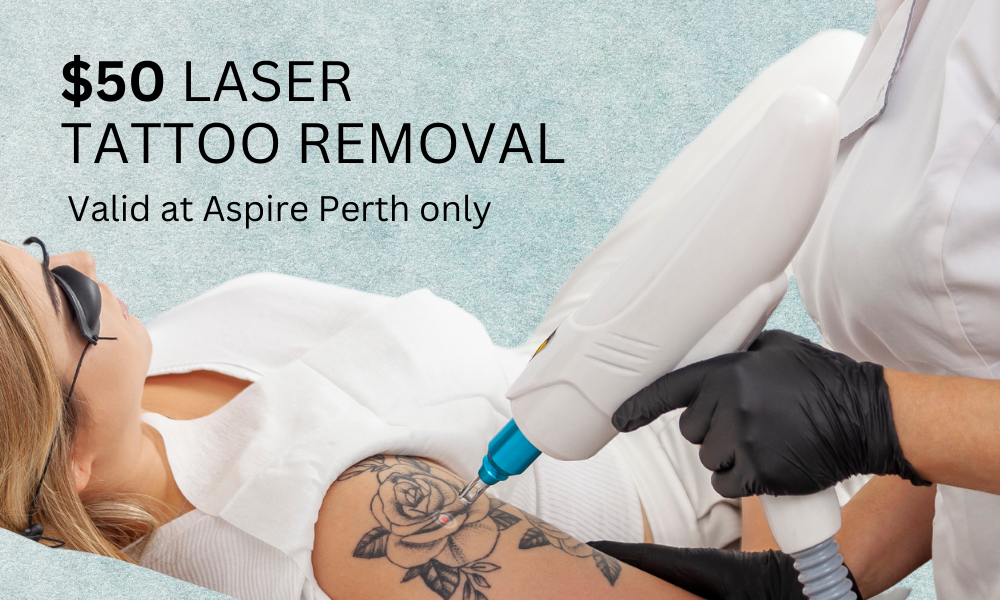 PAY $50 FOR LASER TATTOO REMOVAL